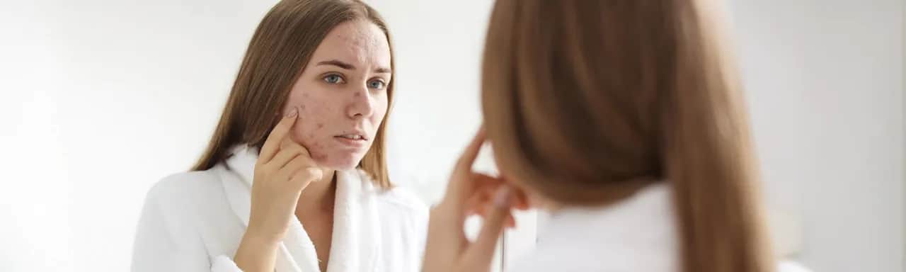 Kremy do cery suchej z wypryskami – jak uniknąć podrażnień?