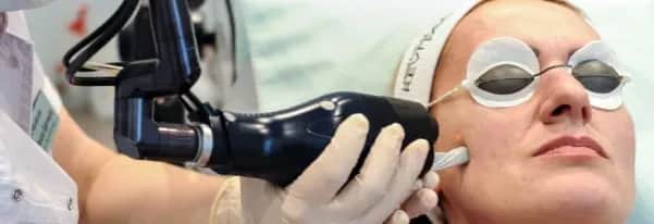 Kiedy znikają przebarwienia po laserze frakcyjnym? Oto co musisz wiedzieć