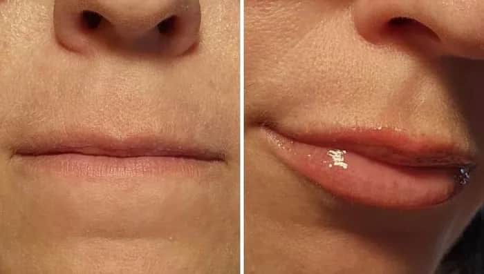 Czy błyszczyk powiększający usta działa? Odkryj prawdę o efektach