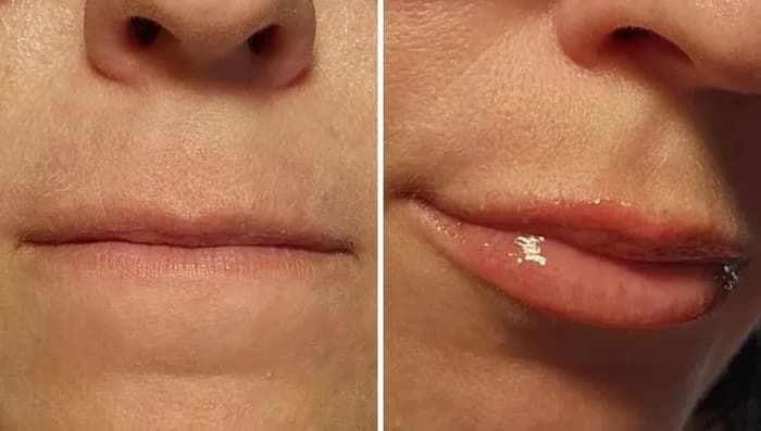 Czy błyszczyk powiększający usta działa? Odkryj prawdę o efektach