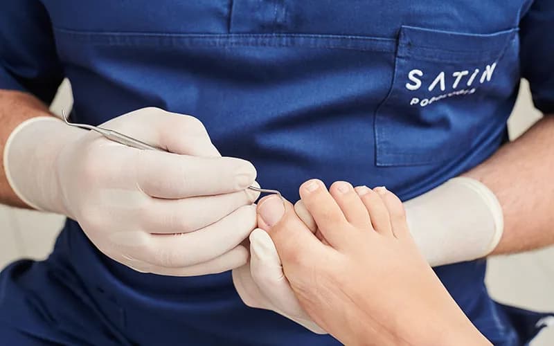 Jak obciąć zgrubiałe paznokcie bez bólu i ryzyka uszkodzeń