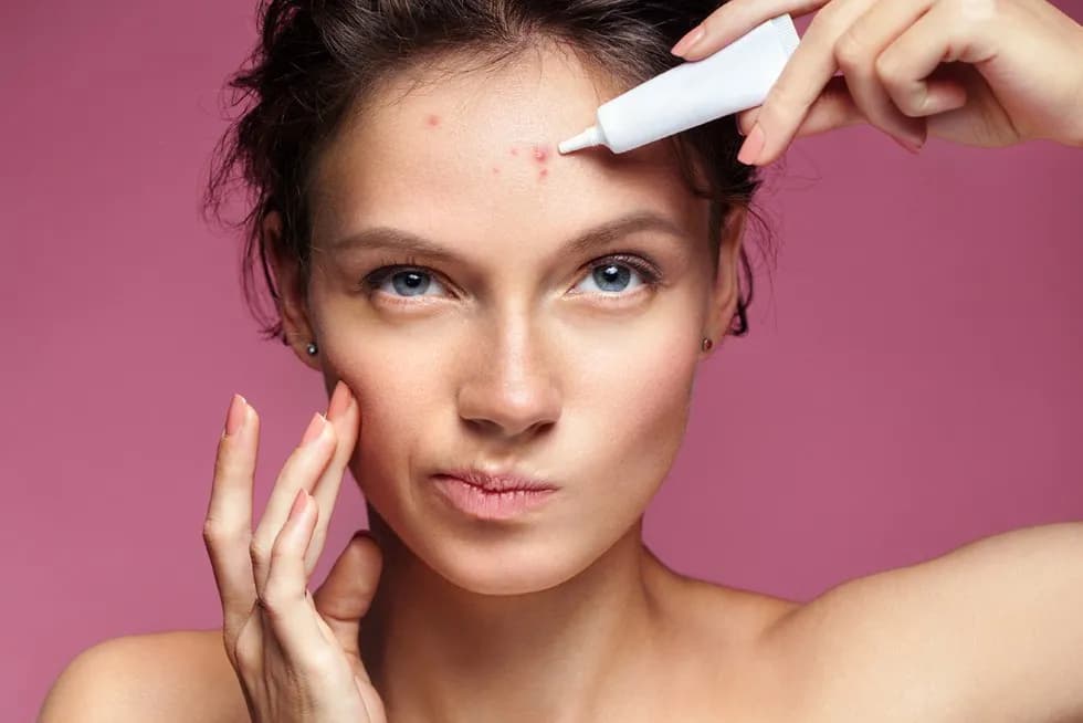 Skuteczne metody na pryszcze - jak szybko pozbyć się problemu