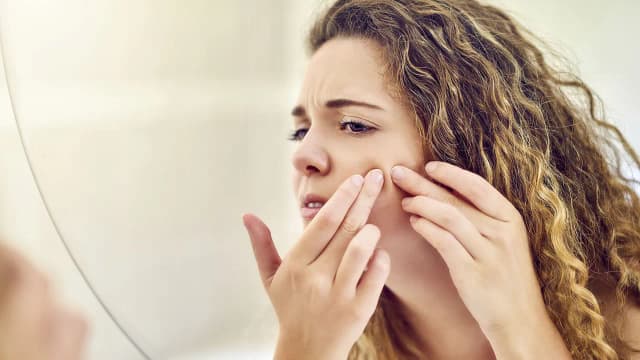 Jak powstają pryszcze? Odkryj ich przyczyny i skuteczne metody zapobiegania