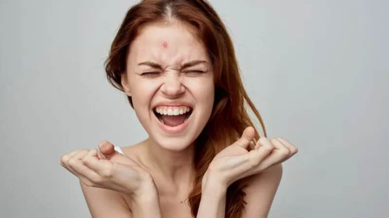 Jak pozbyć się pryszczy domowe sposoby, które naprawdę działają