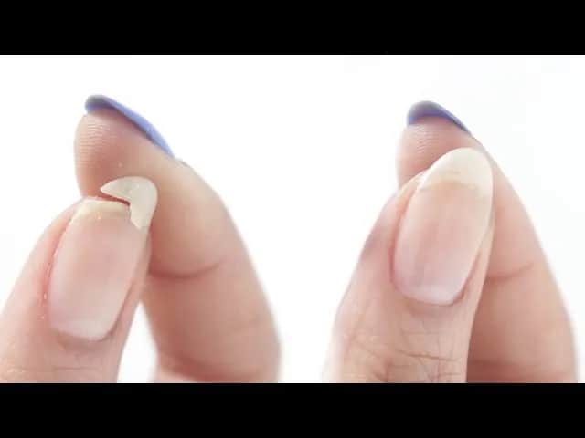 Czy pęknięty paznokieć się zrośnie? Odkryj prawdę o regeneracji