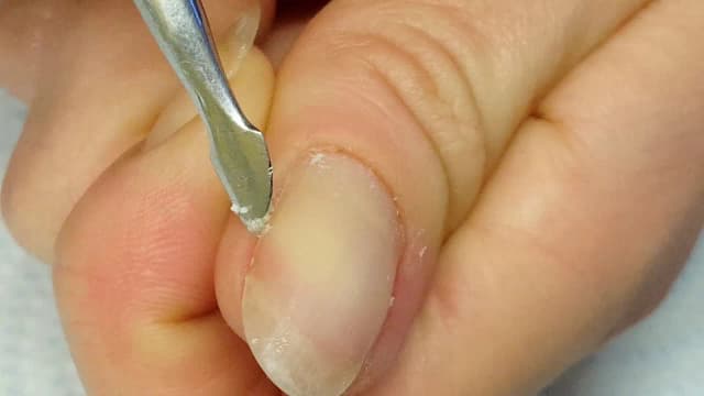 Jak zmiękczyć skórki przy paznokciach domowe sposoby, które działają